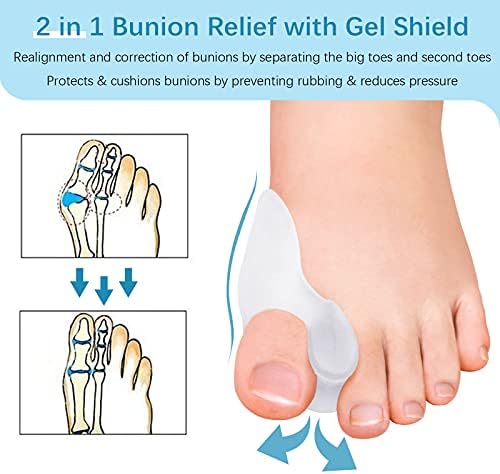 MENOCADY Paquete de 12 Cojines y Protectores para Juanetes, Almohadilla de Gel de 1/2'' de Grosor, Corrector con Separador para el Dedo Grande, - imagen 3