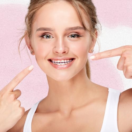 Juego de 2 Piezas de Brackets Falsos para Decoración Dental con Alambres Metálicos, Soportes y Bandas Ortodónticas, Ideal para Ortodoncistas y - imagen 4