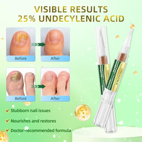 Lápiz Tratamiento para Hongos en Uñas Extra Fuerte – Repara Uñas Amarillas, Descoloridas, Gruesas y Encarnadas – Solución para Uñas de Pies y Manos – - imagen 2