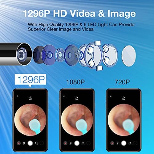 Kit de Remoción de Cerumen con Cámara, Otoscopio Inalámbrico 1296P FHD, 6 Luces LED, 6 Cucharas y Herramientas Tradicionales para iPhone, iPad y - imagen 2