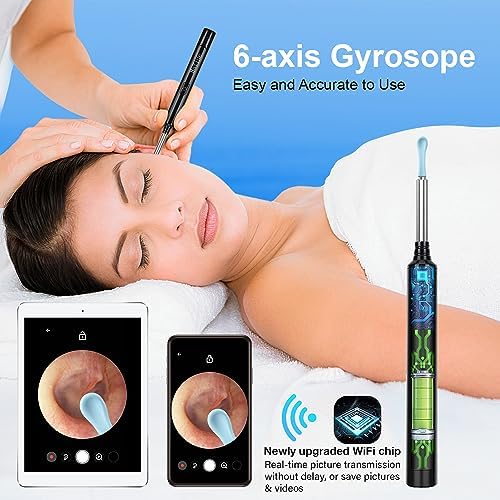 Kit de Remoción de Cerumen con Cámara, Otoscopio Inalámbrico 1296P FHD, 6 Luces LED, 6 Cucharas y Herramientas Tradicionales para iPhone, iPad y - imagen 4