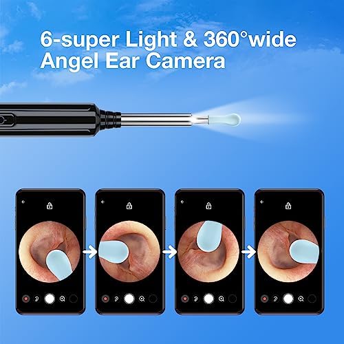 Kit de Remoción de Cerumen con Cámara, Otoscopio Inalámbrico 1296P FHD, 6 Luces LED, 6 Cucharas y Herramientas Tradicionales para iPhone, iPad y - imagen 7