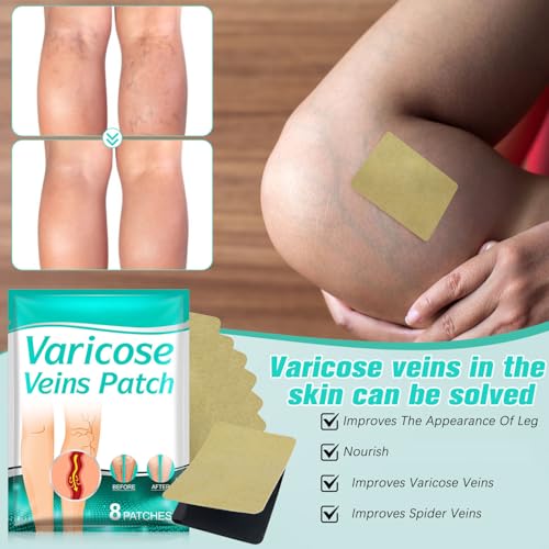 Parche Varicoso para Piernas EOIRULA - 2 Cajas, Tratamiento Profesional para Venas Varicosas - imagen 6