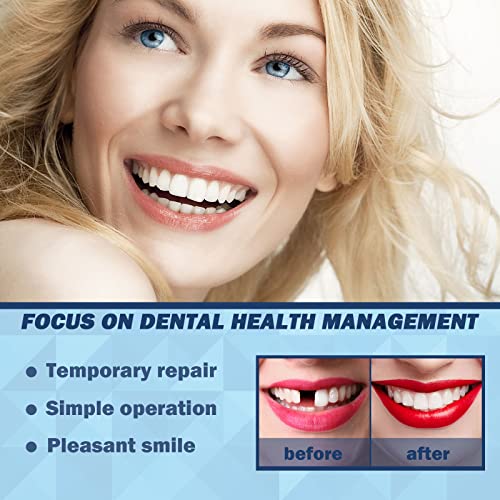 56 Piezas de Dientes Falsos, 2 Juegos de Dientes Sintéticos de Polímero, 22 Tonos A2 para Dentaduras Superiores e Inferiores, Reemplazo, DIY o - imagen 4