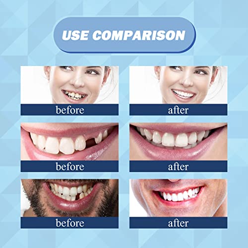 56 Piezas de Dientes Falsos, 2 Juegos de Dientes Sintéticos de Polímero, 22 Tonos A2 para Dentaduras Superiores e Inferiores, Reemplazo, DIY o - imagen 5