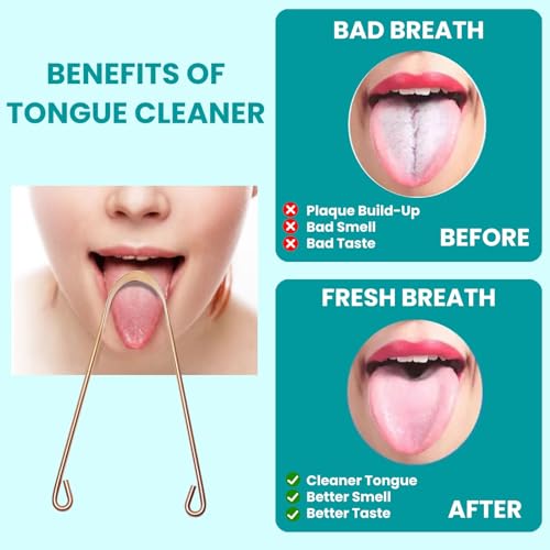 Set de 2 Raspadores de Lengua de Cobre, Limpiador Oral para Adultos y Niños, Cepillo de Lengua de Acero Inoxidable con Doble Hoja y Bolsa de Viaje - imagen 5