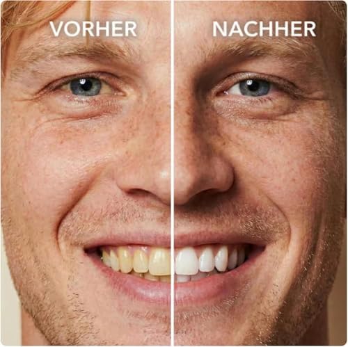SmileFitPro Pintura para Dientes, Pulidor Natural, Kit Portátil de Blanqueamiento Suave, Fórmula Segura y Resultados Duraderos, 2 piezas - imagen 3