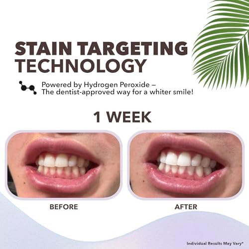 Tiras Blanqueadoras Profesionales Purli para Dientes - Tratamiento de 9 Días, Efectos Profesionales, Seguras para Encías y Esmalte, con Aceite de - imagen 3