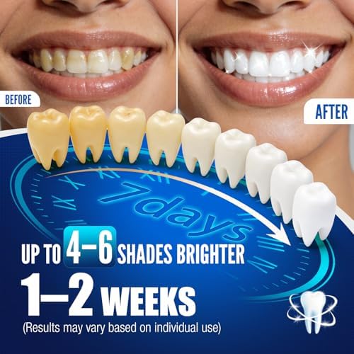 Kit de Blanqueamiento Dental - 35% Peróxido de Carbamida, 2 Lápices Blanqueadores + 1 Lápiz Remineralizante, Cuidado para Dientes Sensibles, 3 x 0.14 - imagen 2