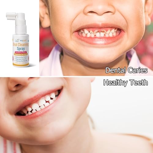 Spray Oral Infantil, Ayuda para Pasta de Dientes de Niños, Prevención de Caries y Aliento Fresco, Anticaries Sin Flúor para Bebés y Niños Pequeños (1) - imagen 2