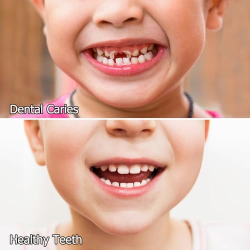 Spray Oral Infantil, Ayuda para Pasta de Dientes de Niños, Prevención de Caries y Aliento Fresco, Anticaries Sin Flúor para Bebés y Niños Pequeños (1) - imagen 4