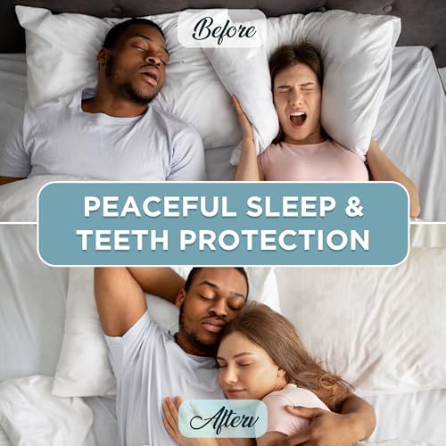 Protector Bucal Anti-Ruido, Férula para Bruxismo Nocturno, Ajuste Perfecto para Dormir, Reutilizable, Paquete de 4 para Adultos - imagen 5