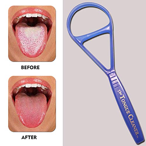 Limpiador de Lengua - Elimina el Mal Aliento y Refresca el Aliento - Tratamiento para el Mal Aliento (Color Puede Variar) - imagen 2