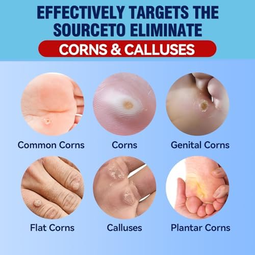 Bellemora Eliminadores de Callos para Dedos y Pies, Paquete de 24 Almohadillas con Adhesivo Impermeable, Alivio Suave del Dolor, Bandaid para Manos y - imagen 2
