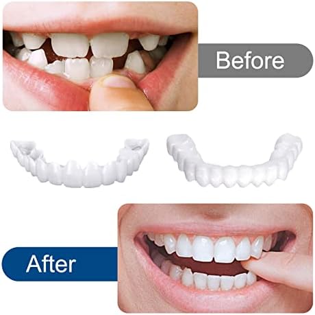 2 Pares de Carillas Dentales Snap en Dientes Comodidad Ajuste Blanqueador Dentaduras Fáciles para Hombre y Mujer, Sonrisa Perfecta en Instantes - imagen 4