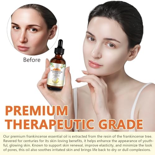 Aceite Esencial de Incienso 60 ml - 100% Puro y Natural, Ideal para Cuidado Personal, Piel, Rostro, Cabello, Alivio de Malestar, Relajación y Masaje, - imagen 5