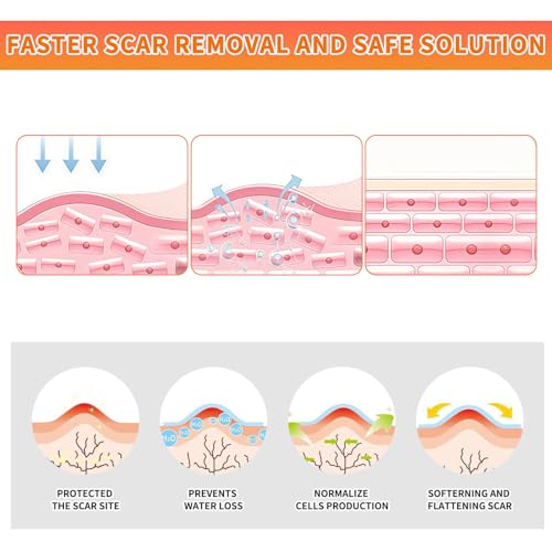 Tiras de Silicón para Cicatrices (Rollos de 1.6x60 - 1.5M), Cinta Médica Reutilizable para Tratamiento de Cicatrices Quirúrgicas, C-Section, - imagen 3
