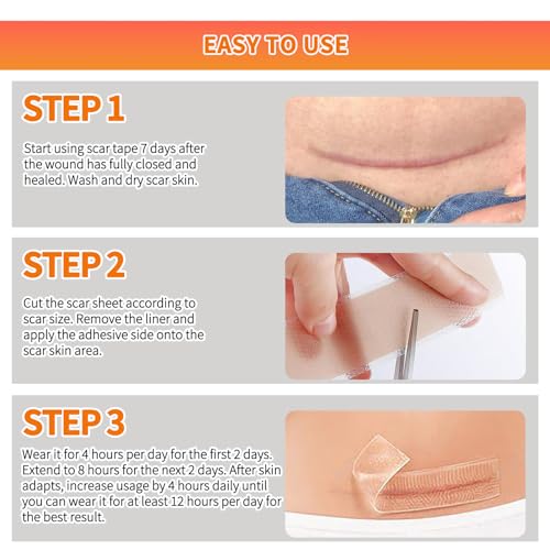 Tiras de Silicón para Cicatrices (Rollos de 1.6x60 - 1.5M), Cinta Médica Reutilizable para Tratamiento de Cicatrices Quirúrgicas, C-Section, - imagen 7