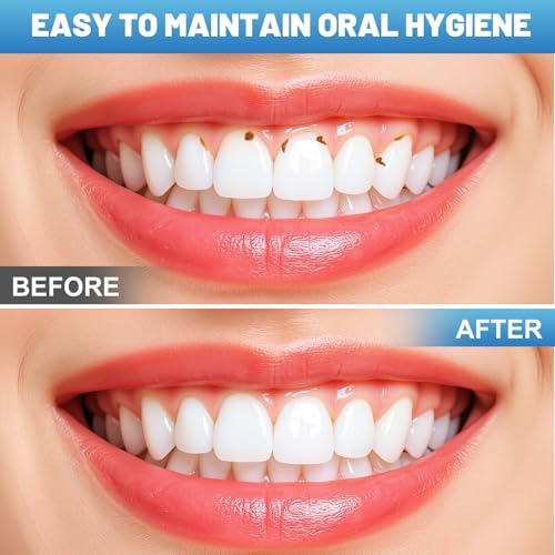 Juego de 10 Cepillos Removedores de Placa Dental Ceonam, Diseño Ergonómico, Kit de Limpieza Multicolor para Cuidado Oral - imagen 5