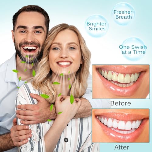 Aceite de Coco SDJUFEI para Enjuague Bucal, 20 Sachets de Aceite para Jalar, Tamaño de Viaje, con Coco y Menta, Natural y Efectivo para Dientes - imagen 7