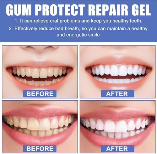 Gel Dental Protect Gum, Solución Profesional para la Salud de las Encías, Gel Reparador, Pasta Sabor Menta, Mejora la Salud General de las Encías - imagen 4