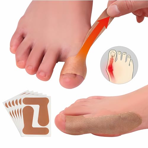 Ortopédicos para juanetes, mejorador de juanetes, 20 PZS de parches autoadhesivos para el dedo gordo, corrector de juanetes para hombres y mujeres, - imagen 1
