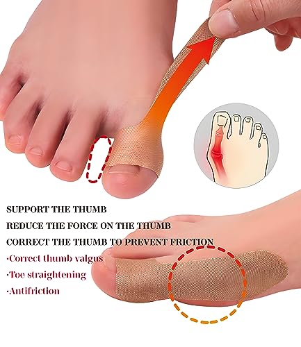 Ortopédicos para juanetes, mejorador de juanetes, 20 PZS de parches autoadhesivos para el dedo gordo, corrector de juanetes para hombres y mujeres, - imagen 2