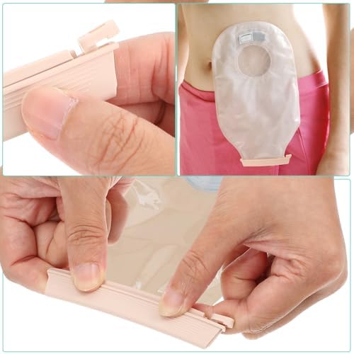 10 Piezas de Clips para Bolsa de Ostomía, Abrazaderas a Prueba de Fugas, Clip de Cierre Reutilizable, Accesorios para Colostomía y Fístula - imagen 5