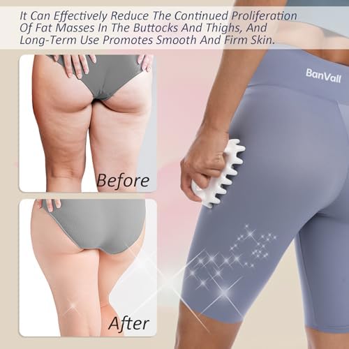 Herramienta de Masaje BanVall para Celulitis, Drenaje Linfático y Tensión Muscular - Masajeador Corporal para Piel Firme y Alivio de Dolores - imagen 3