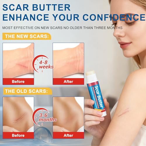 Stick para Cicatrices Scar Butter, Crema con Vitamina E y Manteca de Cacao para Cicatrices, Hidratación Profunda, Ligero y No Graso | 20g - imagen 8