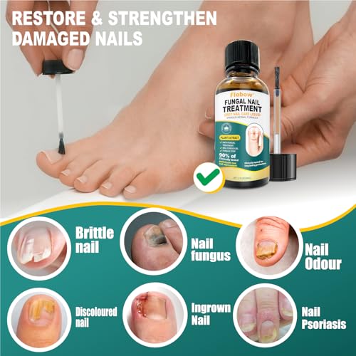Tratamiento para Hongos en Uñas de Flobow - Tratamiento Extra Fuerte para Hongos en Uñas de Pies, Uñas Sanas y Fuertes (A) - imagen 6
