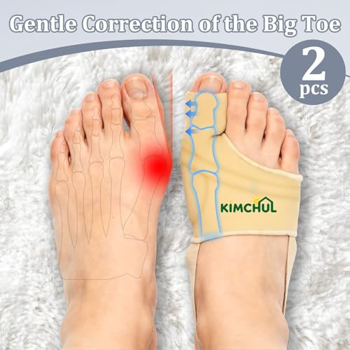 KIMCHUL Corrector de Juanetes 2 Piezas, Unisex, Versión Mejorada - Alivia el dolor y separa el dedo gordo, soporte transpirable para uso diurno y - imagen 2