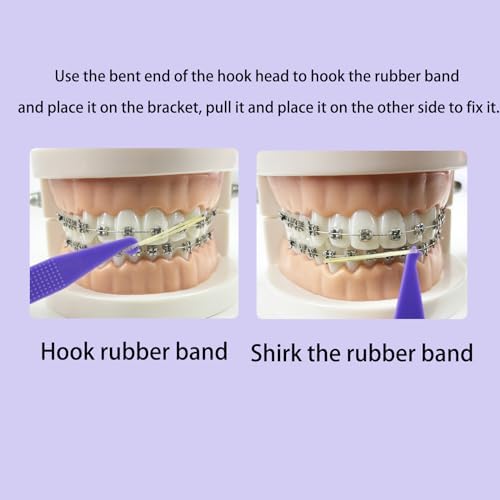 Maoerdental 100 Piezas de Herramientas de Colocación de Bandas de Goma Elásticas para Frenos, Colores, Plásticos Desechables para Ortodoncia - imagen 3