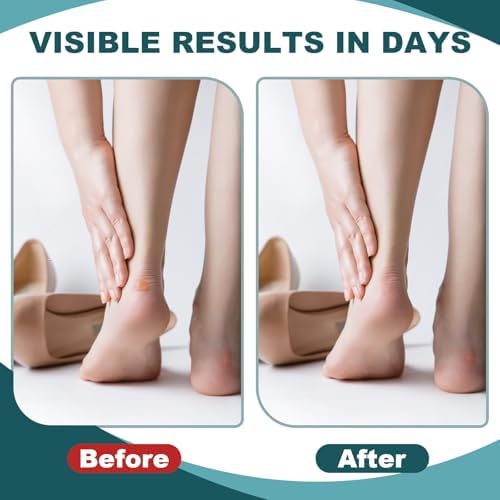30 Piezas de Apósitos Hidrocoloides para Ampollas - Almohadillas Impermeables para Pies, Talones y Dedos - Prevención y Recuperación, Esenciales para - imagen 4
