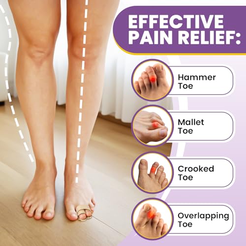 JUMPOW Corrector de Dedo en Garra - Fajas para Dedo Roto, 2 Pzs de Splint para Alivio y Corrección de Dedos en Garra, Rotos, Torcidos y Superpuestos - imagen 2