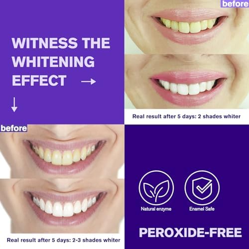 Tiras Blanqueadoras de Dientes Moradas - Fórmula Mejorada sin Residuos - Kit Blanqueador Seguro para Esmalte y Baja Sensibilidad - Tecnología de - imagen 7