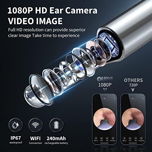 Kit de limpieza de oídos con cámara y luz, 7 piezas, otoscopio 1080P para iOS y Android, incluye 6 cucharas para extracción de cerumen - imagen 2