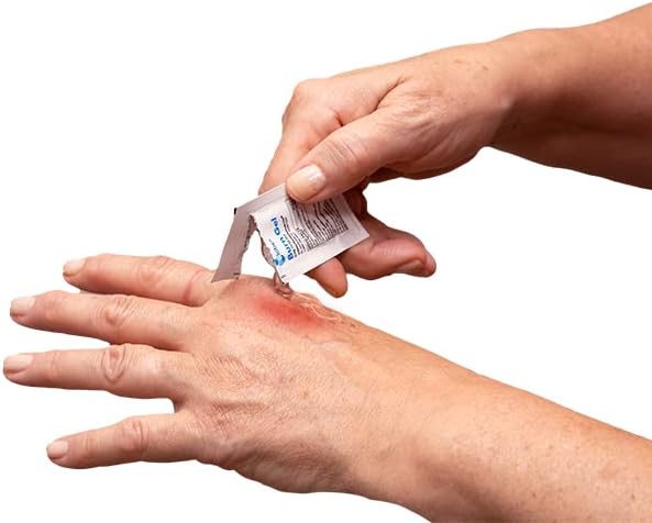 Gel para Quemaduras Globe con Aloe 0.9g, Paquete de 144, Gel Avanzado para ros Auxilios para Alivio Temporal de Quemaduras, Cortes y Raspones - imagen 3