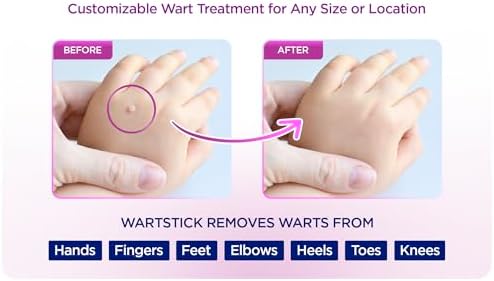 WartStick Eliminador de Verrugas Comunes y Plantares con Ácido Salicílico - Paquete de 2, 0.4 Oz - imagen 2