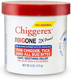 Ungüento Medicado Chiggerex 2X para ros Auxilios y Alivio de Picaduras de Insectos con Aloe Vera y Manzanilla, 6 oz - imagen 1