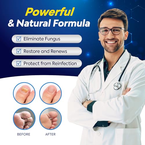Tratamiento para Hongos en Uñas de Pies con 25% de Ácido Undecilénico, Tratamiento Extra Fuerte para Hongos en Uñas - 2 Piezas - imagen 2