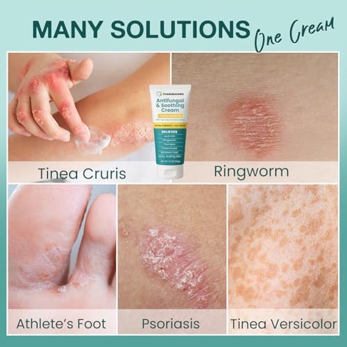 Crema Antifúngica para Picazón en la ingle, Tiña, Psoriasis y Pie de Atleta – Alivio Extra Fuerte para Piel Irritada y Ardor – Fórmula de Acción - imagen 3