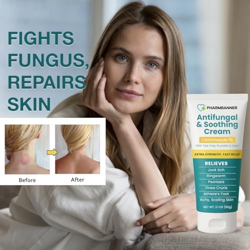 Crema Antifúngica para Picazón en la ingle, Tiña, Psoriasis y Pie de Atleta – Alivio Extra Fuerte para Piel Irritada y Ardor – Fórmula de Acción - imagen 7