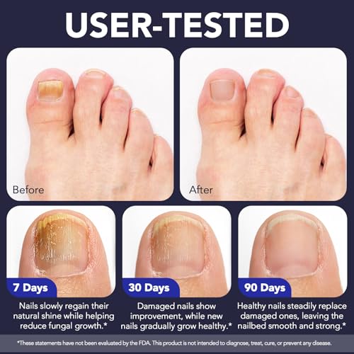 Bolígrafo para Hongos en Uñas - Tratamiento Extra Fuerte para Hongos en Uñas - 25% Ácido Undecilénico con Árbol de Té y Jojoba - Kit Reparador para - imagen 6