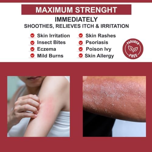 Crema Antipicazón QUATRIDERM NF Extra Fuerte 1% Hidrocortisona con Aloe Vera, Sin Parabenos, 2 oz para Erupciones y Condiciones de Piel - imagen 2