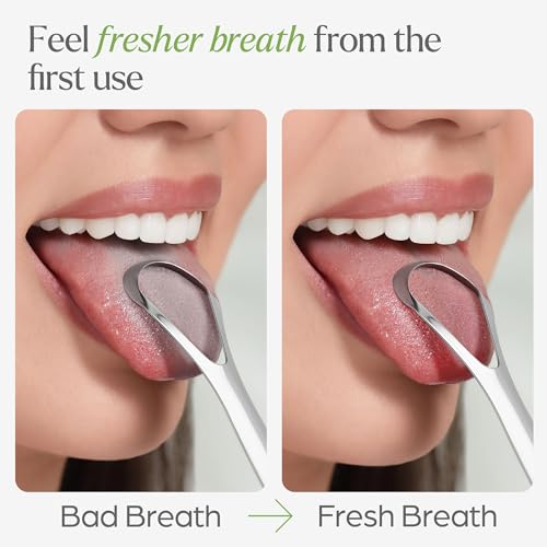Raspador de Lengua VIVAGO para Adultos con Soporte (Paquete de 2) - Raspador de Acero Inoxidable para Limpiar la Lengua y Reducir el Mal Aliento - imagen 4