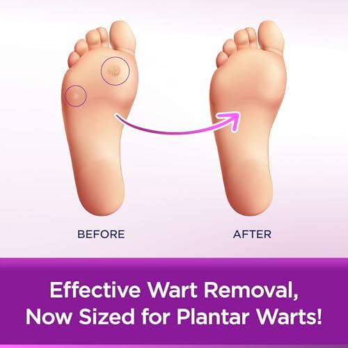 WartStick Plantar - Removedor de Verrugas Plantares con Ácido Salicílico Máxima Fuerza, 0.34 Oz - imagen 3