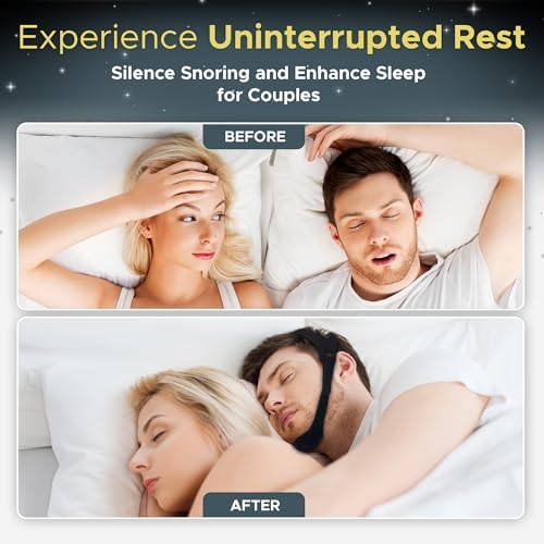 Cinta para la Barbilla para Dormir, Cinta CPAP Antisono, Ajustable y Transpirable, Mantiene la Boca Cerrada y Cómoda - imagen 2
