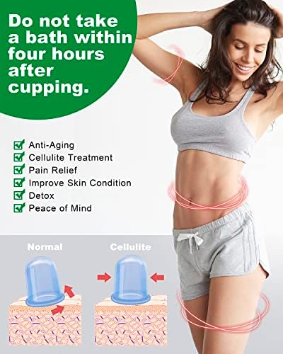 Sets de Terapia de Ventosas SHKIBY de Silicón (Kit de 6 Piezas) - Incluye 2 Copas de Succión Facial, Masajeador Anticelulitis - Ventosas para - imagen 3