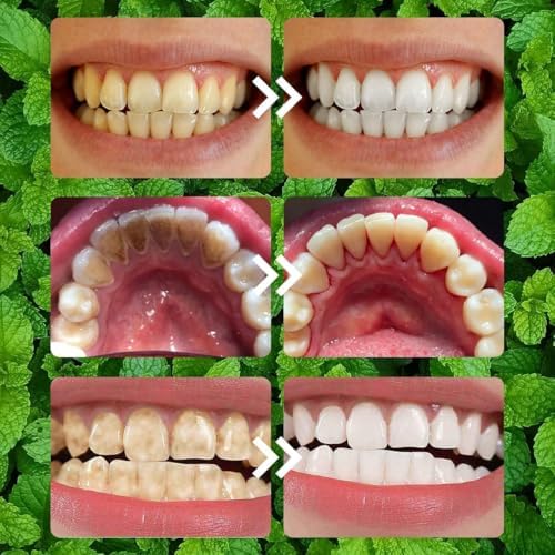 Pó de Mineral para Restauración Dental 2PCS - Fortalece Dientes y Encías, Efectivo para Uso Diario, Color Púrpura - imagen 4